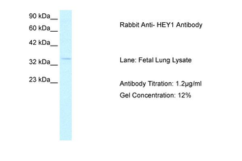 HEY1 Rabbit Polyclonal Antibody