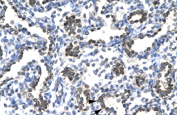 FOSB Rabbit Polyclonal Antibody