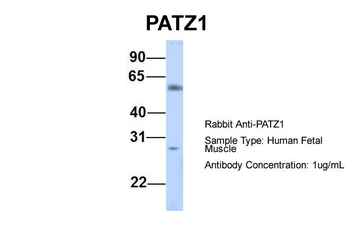PATZ1 Rabbit Polyclonal Antibody