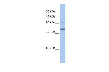 ZKSCAN5 Rabbit Polyclonal Antibody