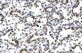 ZNF385 Rabbit Polyclonal Antibody