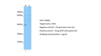 LHX6 Rabbit Polyclonal Antibody