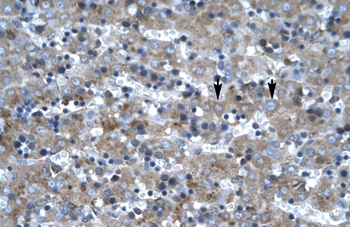 LHX6 Rabbit Polyclonal Antibody