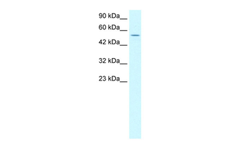LHX6 Rabbit Polyclonal Antibody