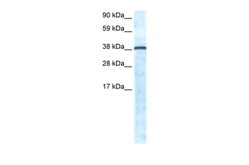 GFI1 Rabbit Polyclonal Antibody