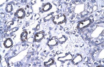 FOXP1 Rabbit Polyclonal Antibody