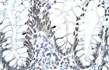 MKX Rabbit Polyclonal Antibody