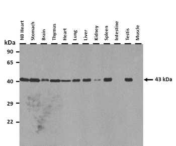 ZFP982 Rabbit Polyclonal Antibody