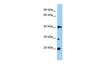 ZFP982 Rabbit Polyclonal Antibody