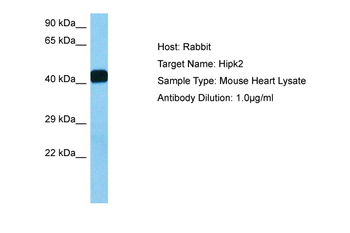 HIPK2 Rabbit Polyclonal Antibody