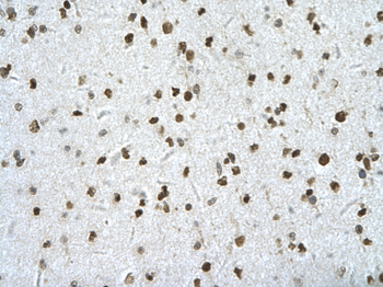 HIPK2 Rabbit Polyclonal Antibody
