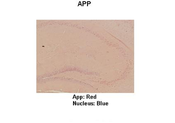 App Rabbit Polyclonal Antibody