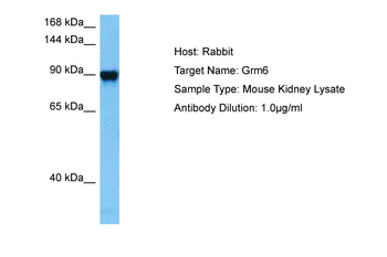 GRM6 Rabbit Polyclonal Antibody