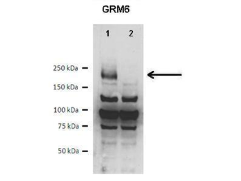GRM6 Rabbit Polyclonal Antibody