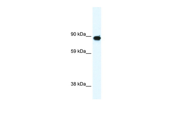 GRM6 Rabbit Polyclonal Antibody