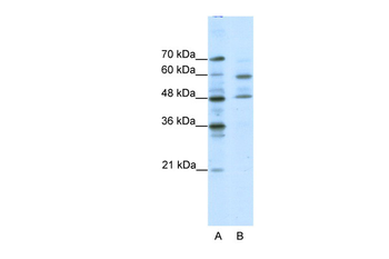 TFCP2L1 Rabbit Polyclonal Antibody