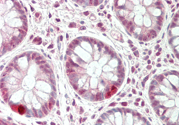 CXXC1 Rabbit Polyclonal Antibody