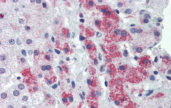HMGN1 Rabbit Polyclonal Antibody