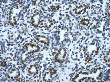 HMGN1 Rabbit Polyclonal Antibody