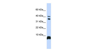 HMGN1 Rabbit Polyclonal Antibody