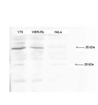 HMX1 Rabbit Polyclonal Antibody