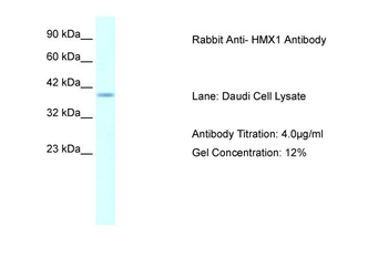 HMX1 Rabbit Polyclonal Antibody