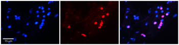 FOXA1 Rabbit Polyclonal Antibody