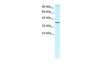 HOXA7 Rabbit Polyclonal Antibody