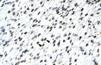 HOXB9 Rabbit Polyclonal Antibody