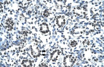 HOXB9 Rabbit Polyclonal Antibody