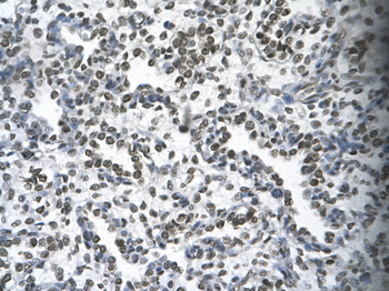 HOXB9 Rabbit Polyclonal Antibody