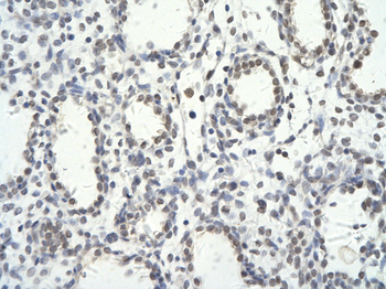 TRIM28 Rabbit Polyclonal Antibody