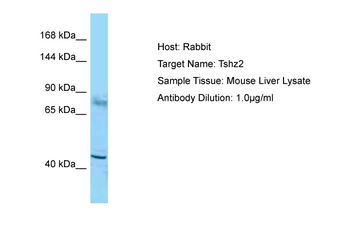TSHZ3 Rabbit Polyclonal Antibody