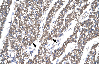 SMAD6 Rabbit Polyclonal Antibody