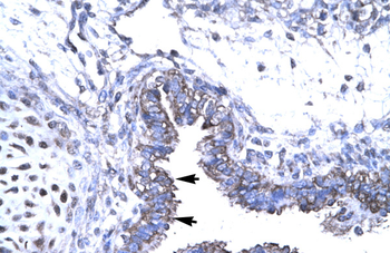 SMAD6 Rabbit Polyclonal Antibody
