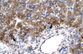 MEOX1 Rabbit Polyclonal Antibody