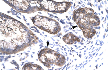 MEOX1 Rabbit Polyclonal Antibody