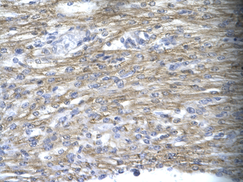 MEOX1 Rabbit Polyclonal Antibody