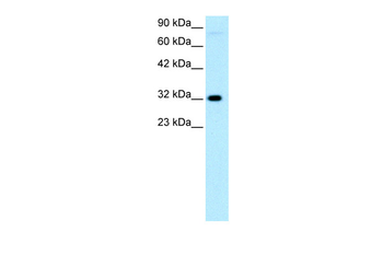 MEOX1 Rabbit Polyclonal Antibody