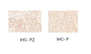 MYT1 Rabbit Polyclonal Antibody