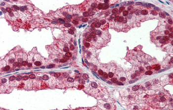 NFIX Rabbit Polyclonal Antibody