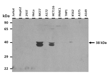 NKX6-1 Rabbit Polyclonal Antibody