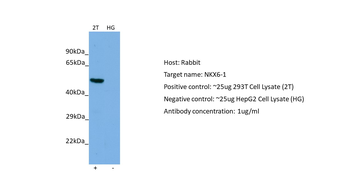 NKX6-1 Rabbit Polyclonal Antibody