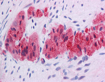 KLF2 Rabbit Polyclonal Antibody