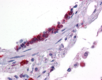 KLF2 Rabbit Polyclonal Antibody