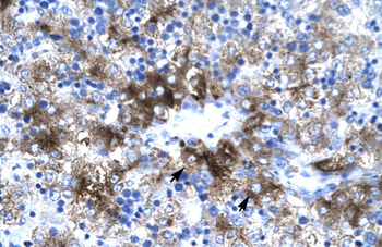 PIAS3 Rabbit Polyclonal Antibody