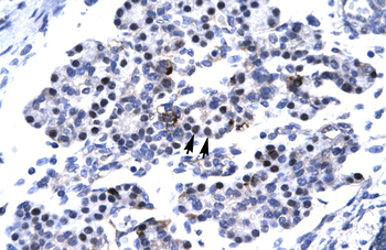 CDX4 Rabbit Polyclonal Antibody