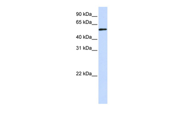 TADA3L Rabbit Polyclonal Antibody