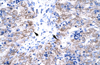 HTATIP2 Rabbit Polyclonal Antibody