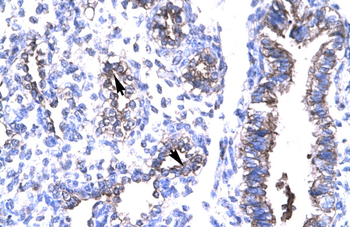 HTATIP2 Rabbit Polyclonal Antibody